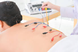 Electro-Acupuncture